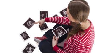 Беременность: ответы на часто задаваемые вопросы